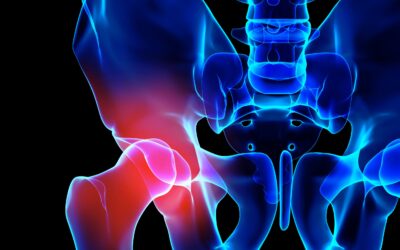 Diagnosis of your hip or knee problem