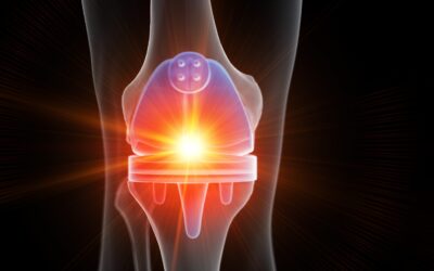 How much is a knee replacement?