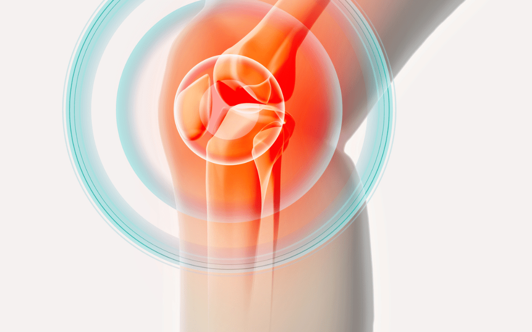 Advancements in Knee Replacement Surgery Techniques